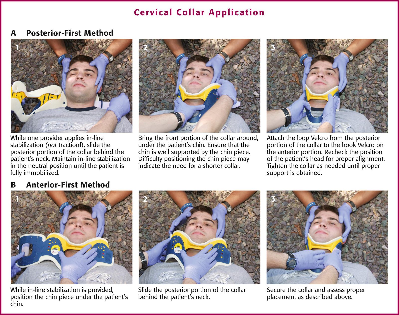 cervical collar application