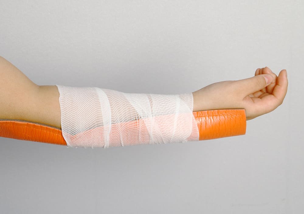 Rolled aluminum-foam moldable splint